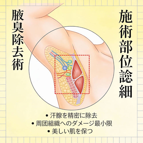 去除尴尬的腋下除味