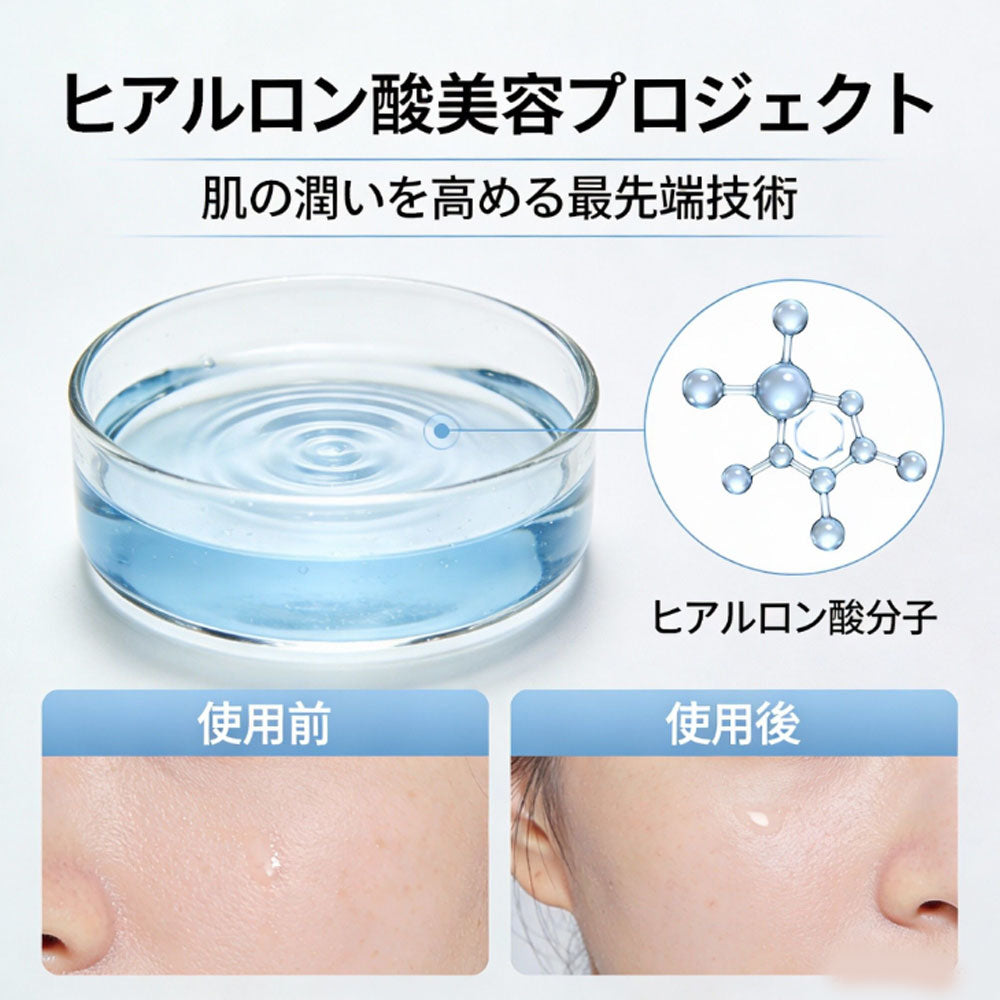 Hyaluronic acid injection