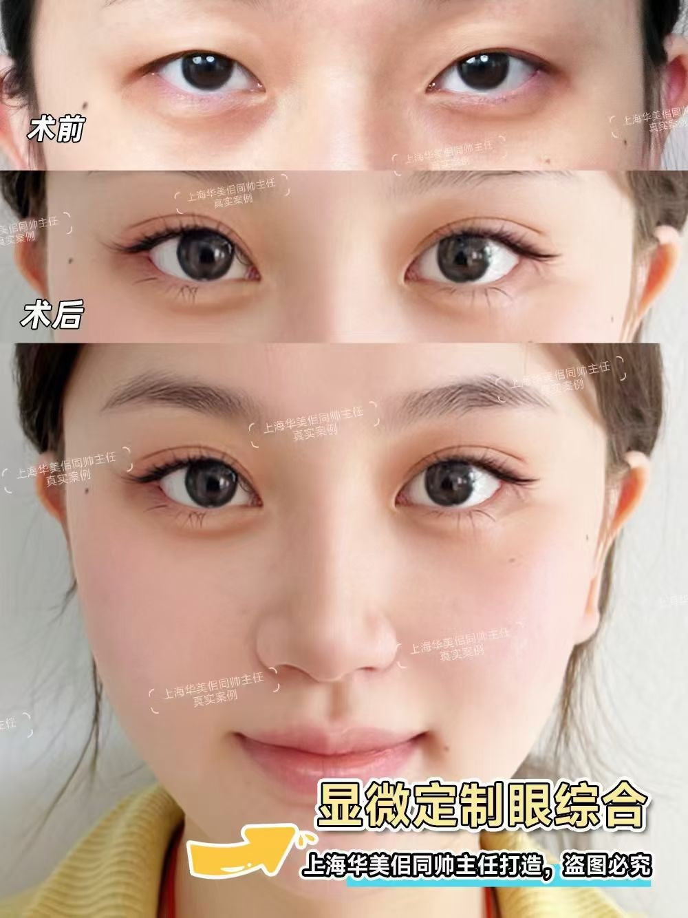 上海华美医疗美容医院