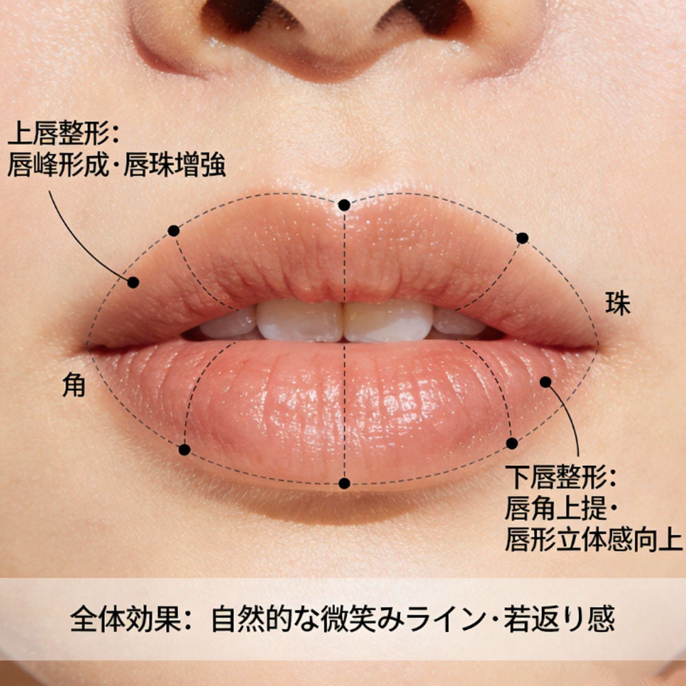 完美嘟嘟唇，唇部缩小术